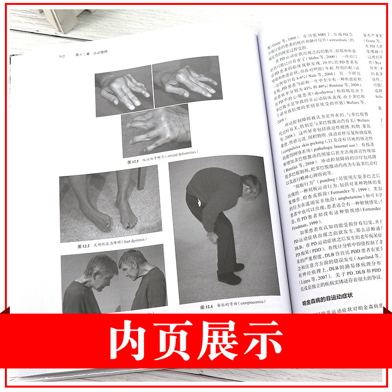 老年神经病学 老年神经科 老年医学的基础研究 老年病人的护理 2020年6月参考书 Anil K Nair编著 9787117291927 人民卫生出版社