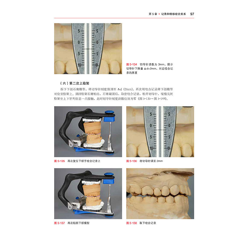 新版咬合功能分析临床实用技术图解第2二版刘洋儿童诱导重建日常技术颌学合学矫治器口腔颌面外科手术调颌颞上下颌窦关节书籍-图1