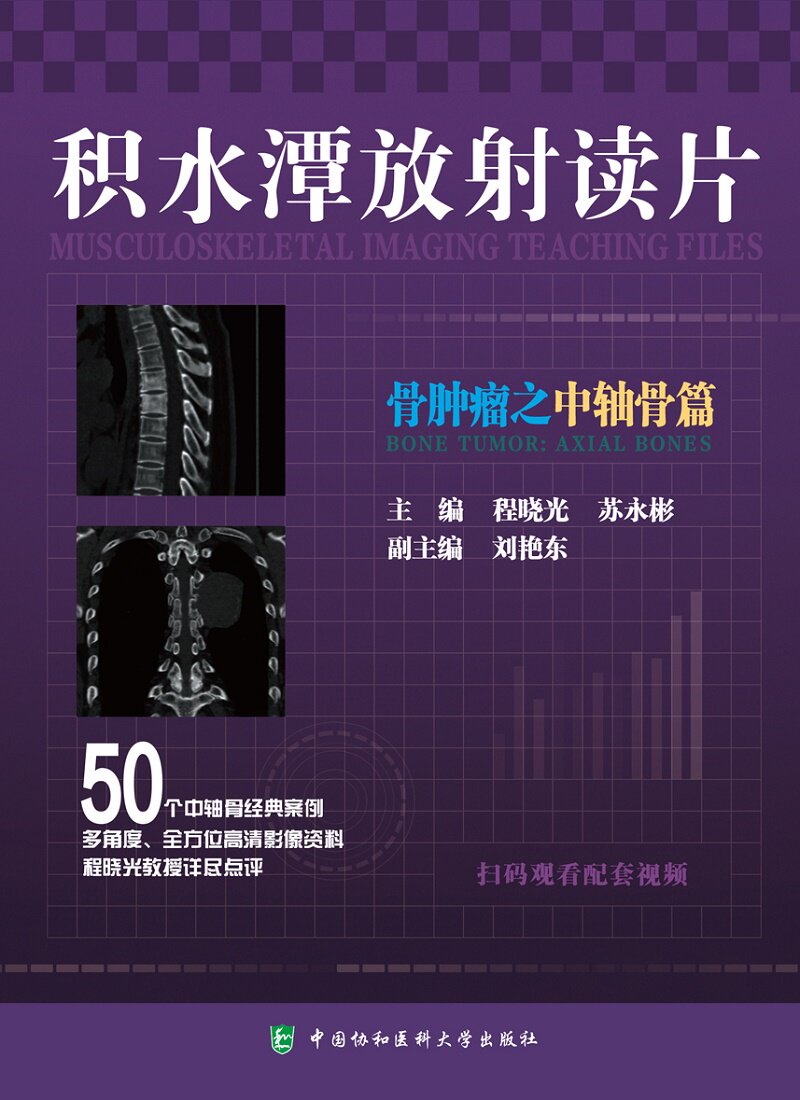 积水潭放射读片 骨肿瘤之中轴骨篇 以病例介绍和点评为主 主要为视频中读片内容的提炼总结 程晓光 苏永彬 中国协和医科大学出版社
