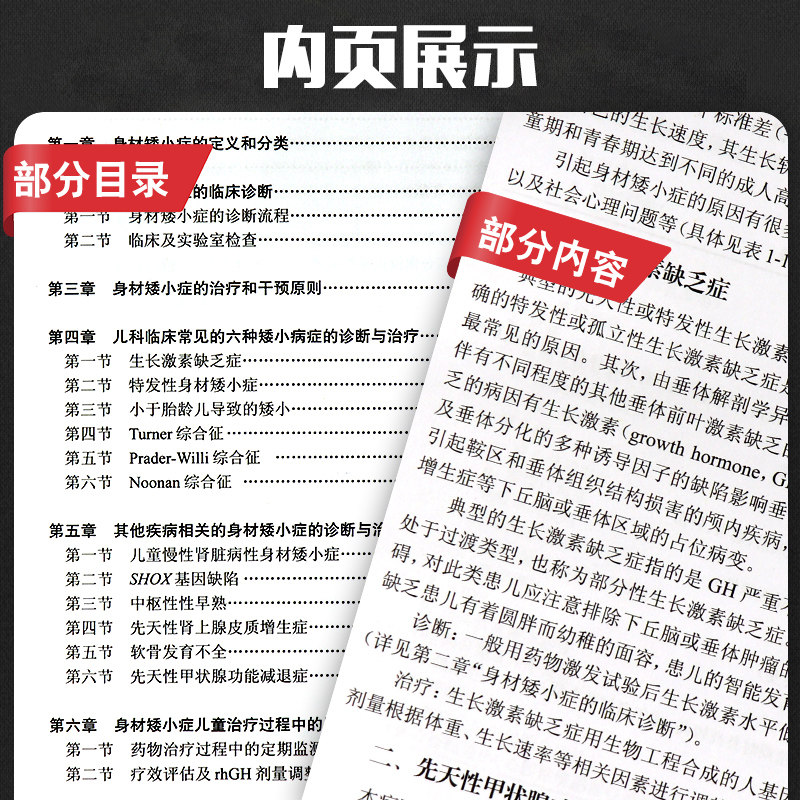 身材矮小症儿童诊疗规范罗小平继续医学教育教材人民卫生出版社儿童身高发育异常诊疗 矮身材诊断治疗及合理用药规范9787117286022