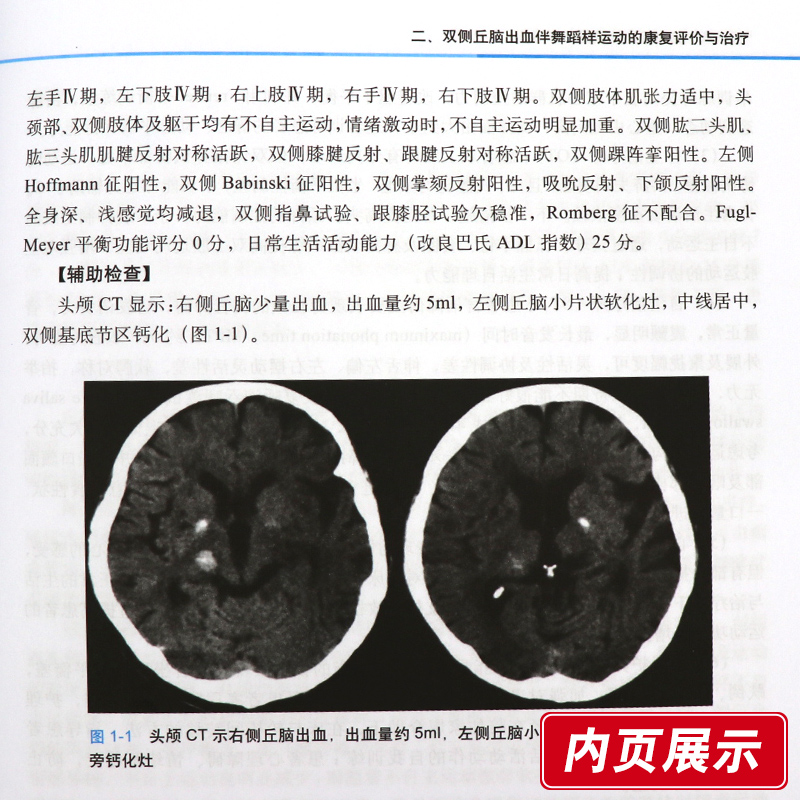 超声正常值测量备忘录 第二版 第2版 超声医学书籍诊断手册b超诊断学彩超测值数值胎儿 杜起军 崔立刚编  科学出版社 - 图2