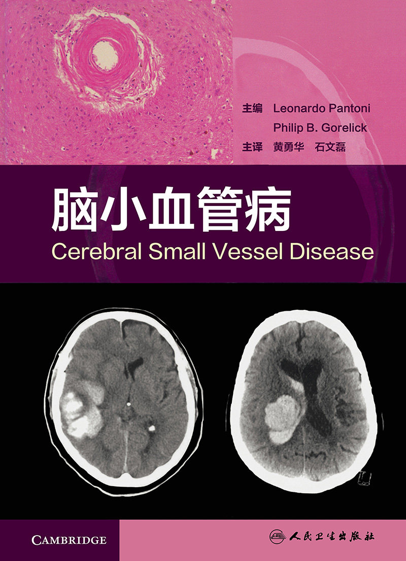 脑小血管病 脑小血管疾病是脑血管疾病的分支学科 临床脑小血管病的分类病理神经影像学治疗 脑血管造影预防心脑血管 心脑血管书籍