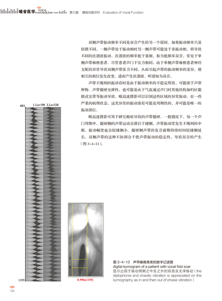 嗓音医学第2版版韩德民嗓音功能评估障碍诊断治疗技术发育器官声带咽喉发音方式基础人民卫生出版社-图0