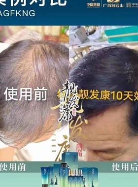 正品靓发康育发液改名盈顺护发精华液100ml 品质保障门店直发养发