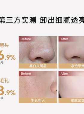 凡茜卸妆膏卸妆清洁去黑头细毛孔