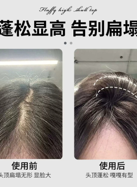 高颅顶神器发根固定夹头发蓬松夹定位夹女定型刘海鸭嘴夹发卡发夹
