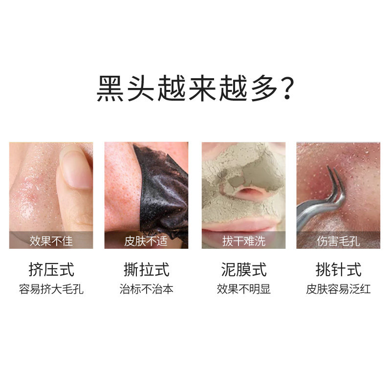 嘉媚乐黑头导出毛孔粗大收细套盒 嘉媚乐面部护理套装