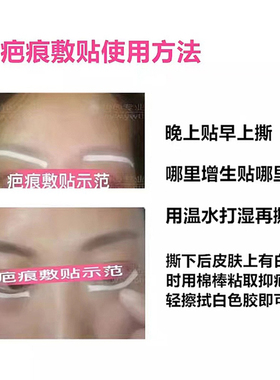 艺维特吉林祛去增生疤痕