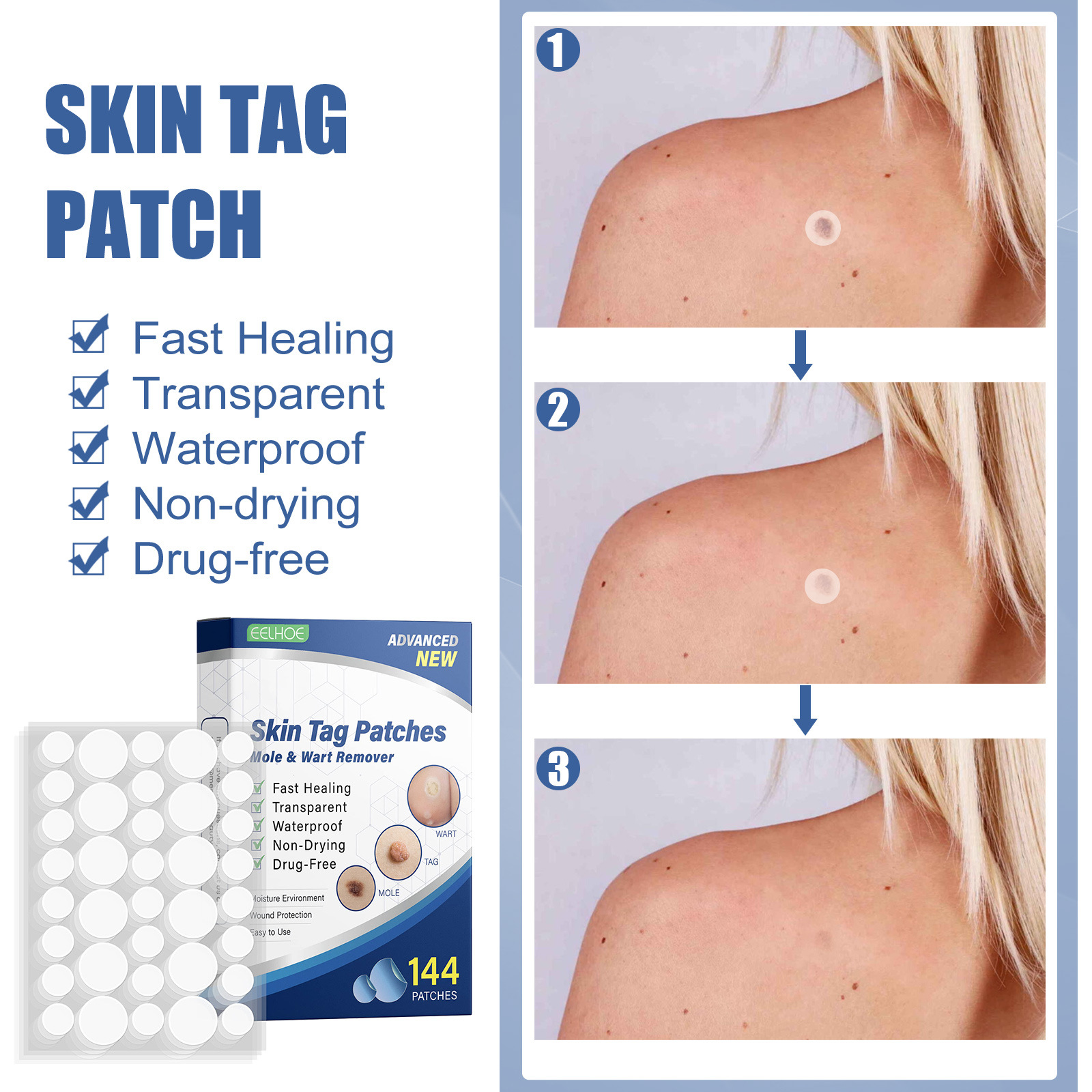 144Pcs Skin Tag Remover Patches Mole Wart Removing Sticker N - 图3