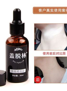 盖脱林白斑遮盖液防水防汗持久
