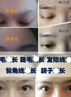 新疆乌斯玛草睫毛营养液乌斯曼
