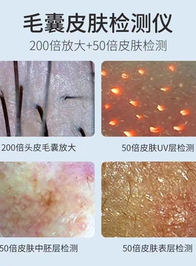 头皮检测仪皮肤测试仪三光谱检测