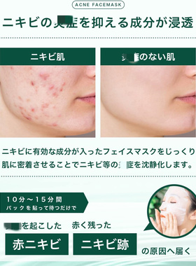 日本本土NILE粉刺抗炎补水面膜护理舒缓修护皮肤晒后红伤30片