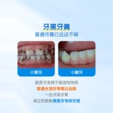 Ao le v6 Дети в возрасте до стоматологической ухода, зубная зубная зубная зубная зубная паста до зубного зуба Черный зубчатый желтый зуб.