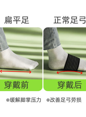 护脚心垫男运动扁平足鞋垫足弓支撑塌陷持久护足涌泉穴按摩护脚垫