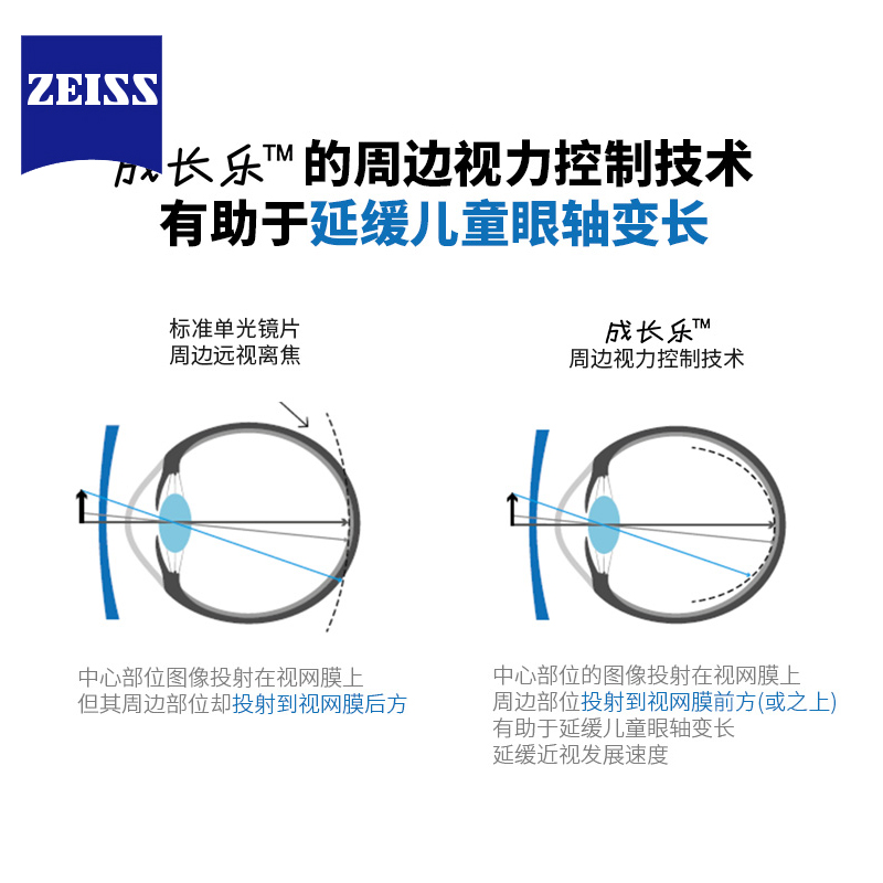 蔡司儿童成长乐镜片莲花膜铂金膜离焦减缓近视镜片学生防控眼镜