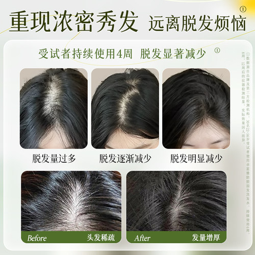 卓蓝雅生姜防脱固发头皮洗发水去屑蓬松控油滋养修护清洗头膏正品 - 图0