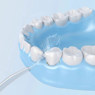 小米米家电动冲牙器家用便携式牙缝水牙线口腔清洁牙结石洗牙器具