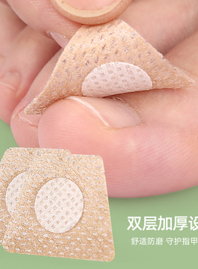正甲贴甲沟垫片嵌甲专用指甲矫正