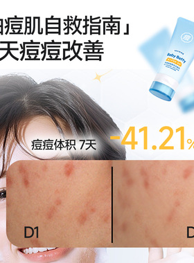 babybetty控油祛痘雪泥洁面乳80g