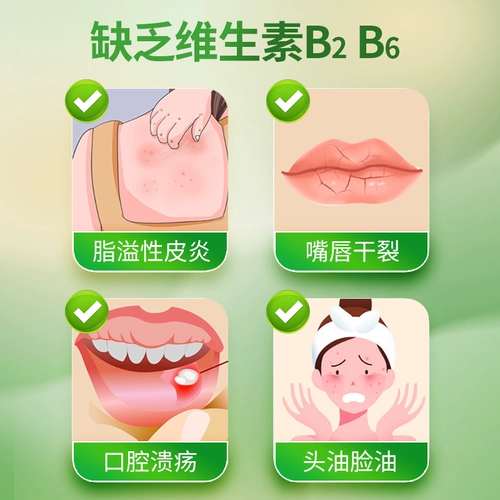 维福佳 Витамин B2 и B6 Взрослые таблетки 100 таблеток себорея-дерматита Аутентичный официальный флагманский магазин для некрипционной