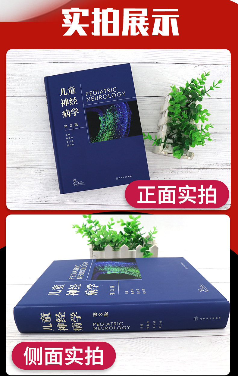 两本套装儿童神经病学 第3版+诸福棠实用儿科学第9版 全两册 全国各级医院儿科医师的案头经典 常见疾病诊疗 常见症状的鉴别诊断