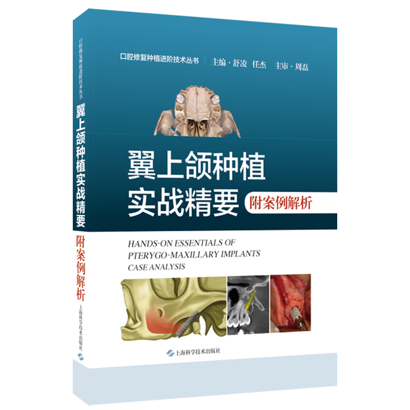 翼上颌种植实战精要附案例解析 舒凌 任杰 适合口腔种植科医师阅读 上颌磨牙区垂直骨高度不足 上海科学技术出版社 9787547865705