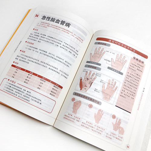 超简单手疗消百病全书 手指经络人体神经系统 手指指纹诊病 903幅图解手指病理 手掌穴位 中医养生保健诊疗书籍 - 图1