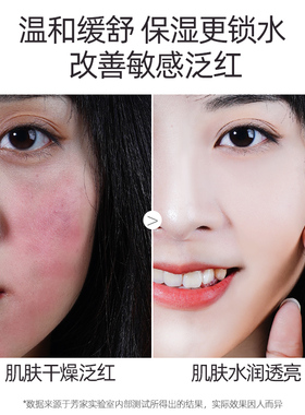 神经酰胺爽肤水补水保湿红护皮肤屏障角质层清爽不油腻旗舰店女