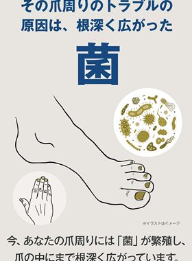 北之快适灰色指甲浸透殺菌