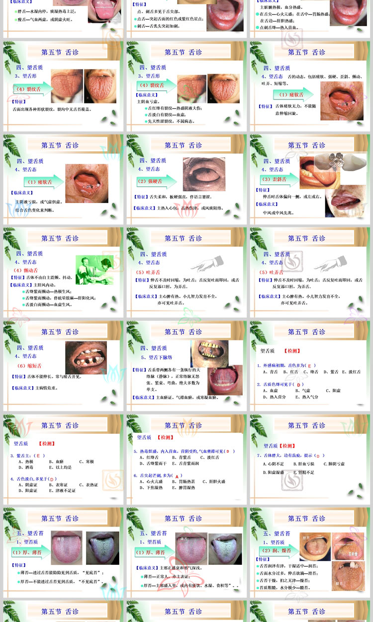 中医诊断学之舌诊治疗PPT模板舌头疾病小儿舌诊眼诊医疗医学舌苔 - 图2