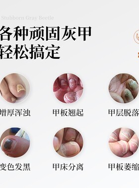 冰王灰甲止凝胶20g甲可迪凝胶