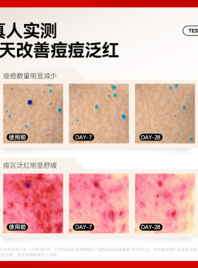 【官方正品】红之温和抗痘洁面乳