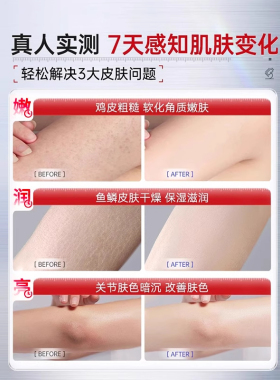 维a乳胶膏和尿素维e乳软膏淡化