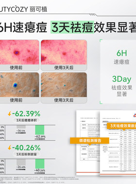 【明星推荐】丽可植小绿瓶祛痘精华液水杨酸控油粉刺修护收缩毛孔