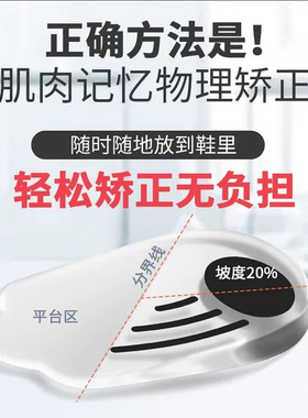 小腿肌肉外翻矫正o型腿鞋垫