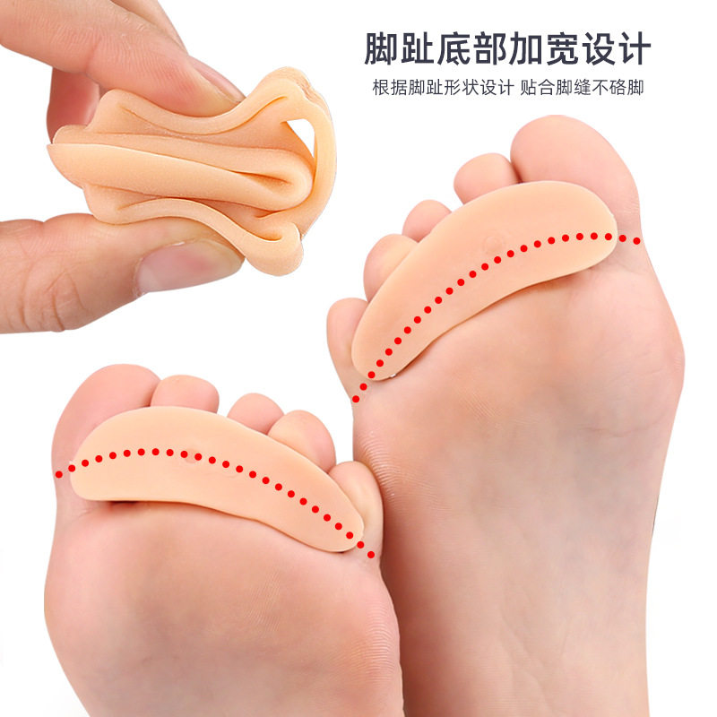 脚趾矫正器重叠趾分离脚趾畸形矫正日用可穿鞋柔软硅胶三环分指器
