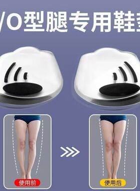 XO型腿矫正鞋垫内外八字脚纠正器