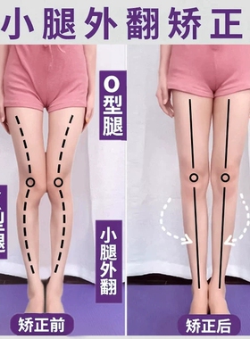 硅胶鞋垫小腿外翻矫正器腿型成人