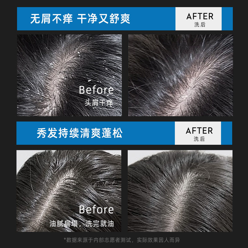 采乐洗发水控油蓬松强力去屑洗发露男士专用长久留香官方正品 图 4