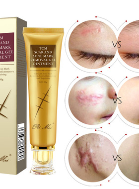 Acne Scar Removal Cream Skin Repair Face Cream Acne Spot