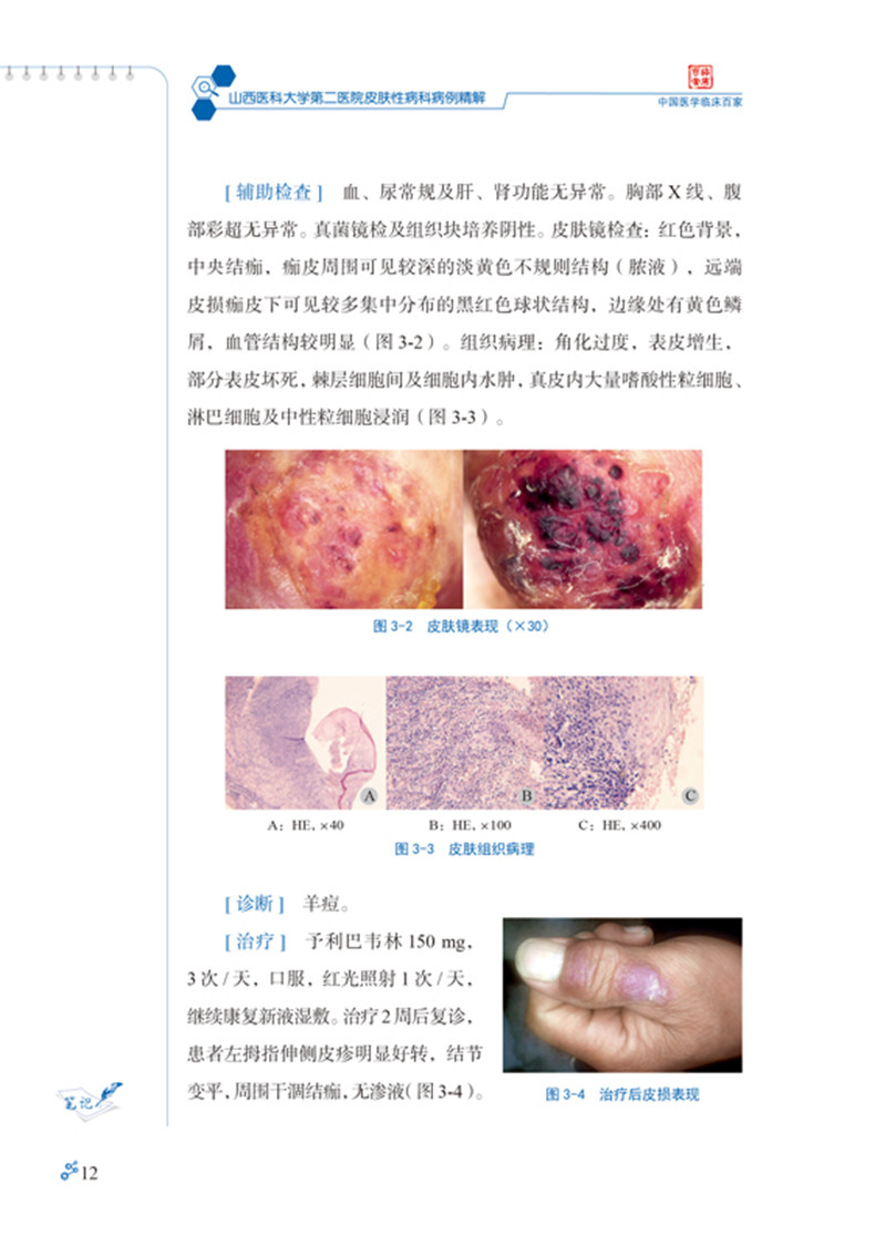 山西医科大学第二医院皮肤性病科病例精解 中国医学临床百家病例精解 冯文莉皮肤性病学书籍科学技术文献出版社9787518977925