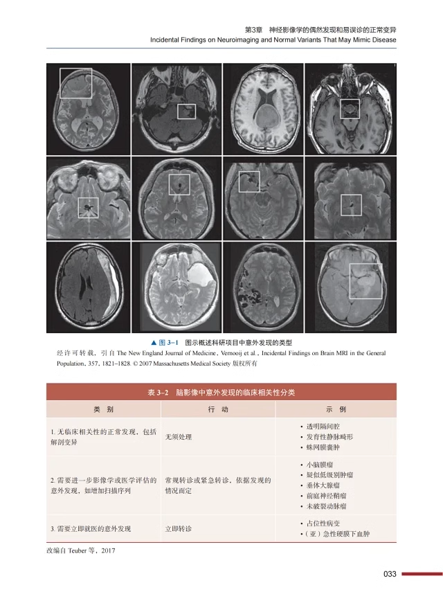 ESNR临床神经放射学上下全2卷张龙江刘亚欧主译神经系统各类疾病影像学表现临床经典病例中国科学技术出版社9787523600979-图2