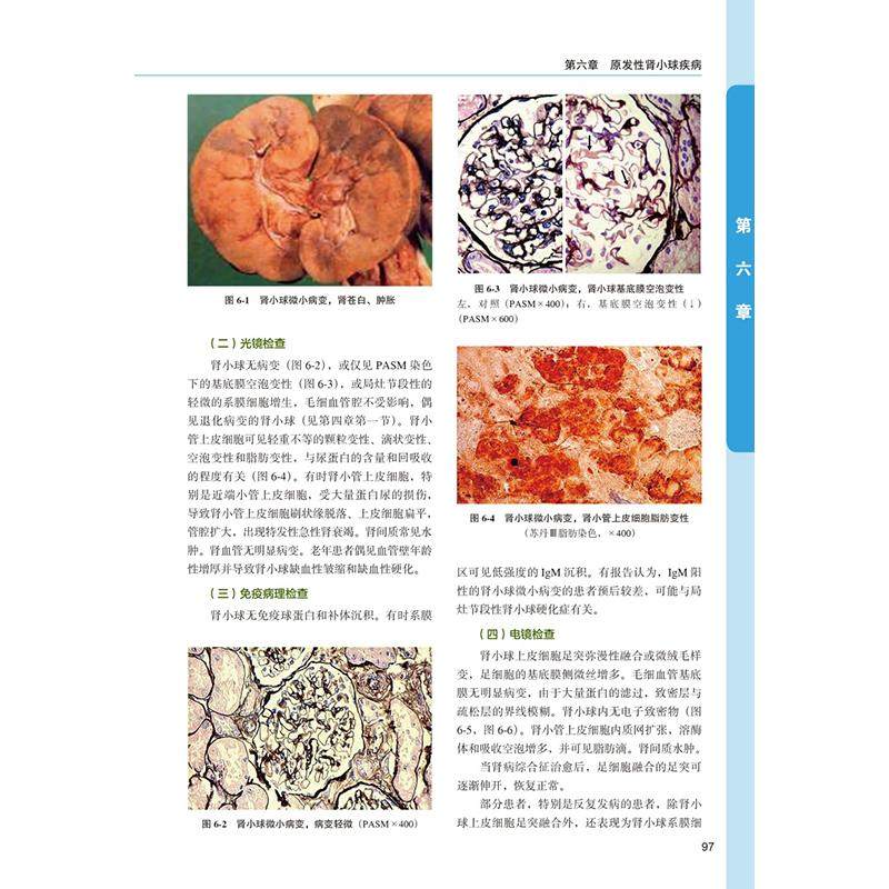 肾活检病理学第6六版 邹万忠 包含北京大学病理学系第一医院肾内科和肾脏疾病研究所多年积累的大量肾活检等资料北京大学医学出版,淘宝优惠券,粉丝福利购,淘宝优惠卷