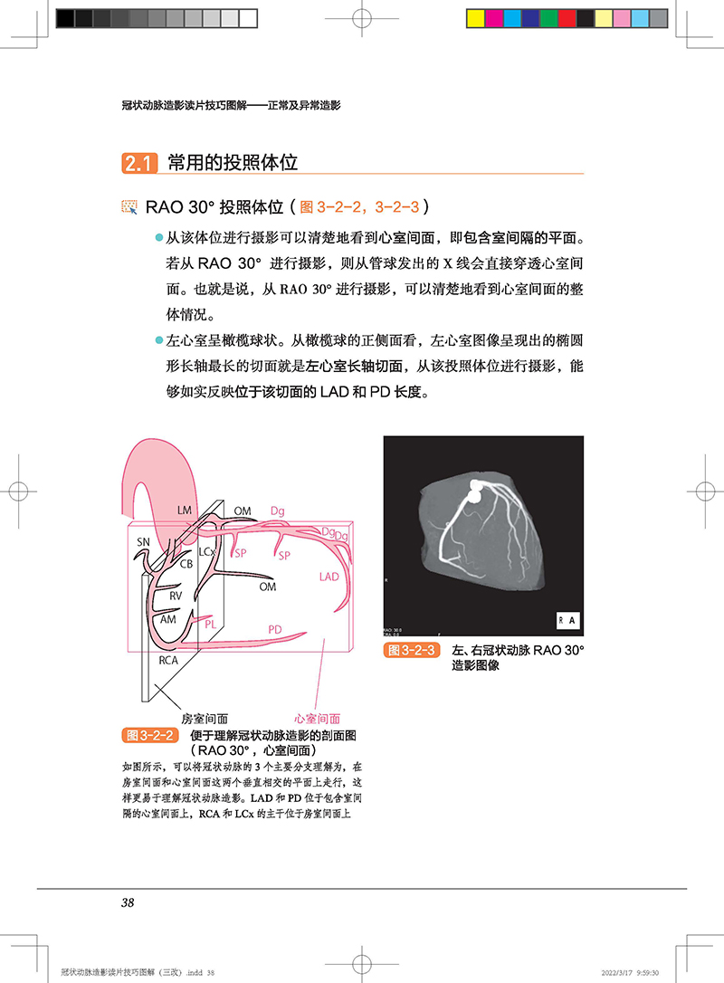 冠状动脉造影读片技巧图解正常及异常造影中川义久林秀隆从冠脉造影小白快速进阶PCI达人视频版北京科学技术出版9787571419929-图2