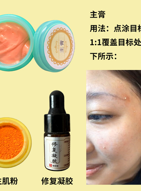 点痣膏无痕正品祛脸部痦子雀斑不留疤黑痣黑点无痕神器专用药水