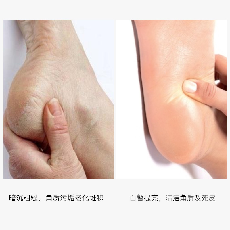 泊蝶旗舰店拍五件|泊蝶山羊奶脚足膜嫩白去角质补水保湿防干裂淡化细纹正品3