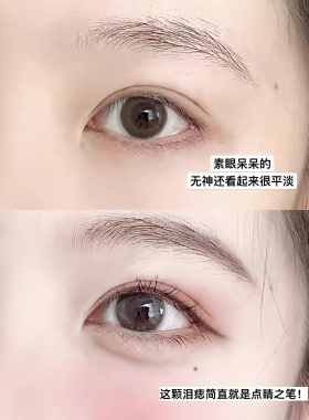 原生点痣雀斑笔不易掉色
