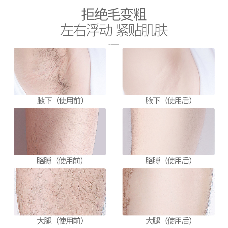 奔腾上海专卖店奔腾电动脱毛器女士刮腋毛腿毛刀阴毛修剪神器私处剃毛家用脱毛仪1