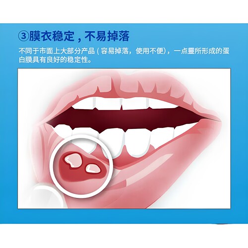 牙得安一点灵 口腔不适粘膜护理 口舌起泡白点疼痛 送专用涂药棒 - 图3